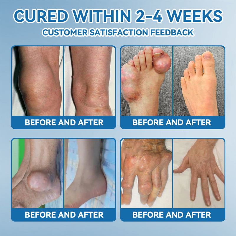 Aeehfeng® Only 6 left! Enjoy an extra 30% off! Experts recommend purchasing 4-5 pieces at once for optimal joint repair and protection. Don't wait—take the first step toward pain-free movement today!