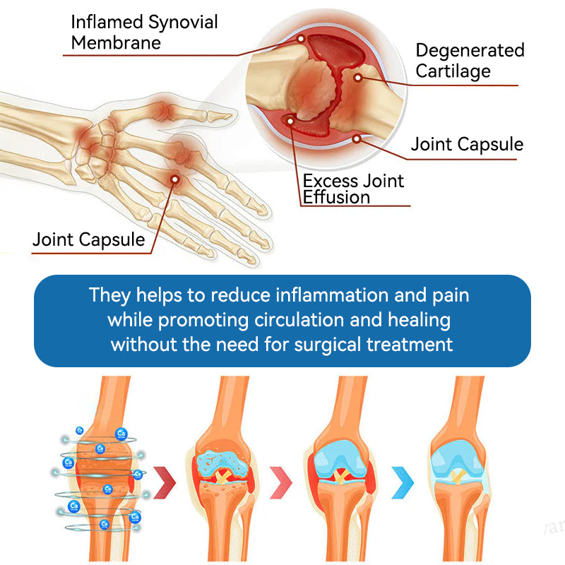 Aeehfeng® Only 6 left! Enjoy an extra 30% off! Experts recommend purchasing 4-5 pieces at once for optimal joint repair and protection. Don't wait—take the first step toward pain-free movement today!