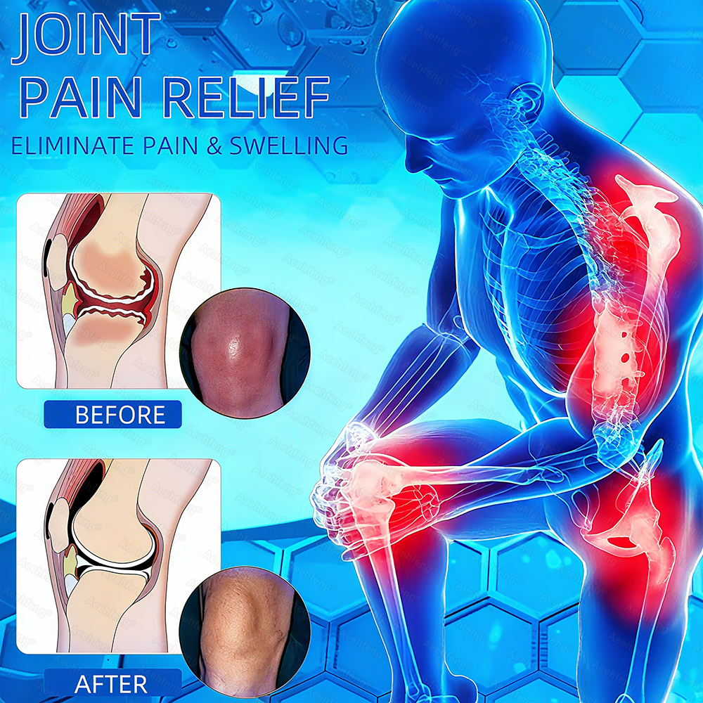 Aeehfeng® Only 6 left! Enjoy an extra 30% off! Experts recommend purchasing 4-5 pieces at once for optimal joint repair and protection. Don't wait—take the first step toward pain-free movement today!