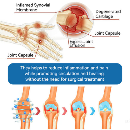 Aeehfeng® Only 6 left! Enjoy an extra 30% off! Experts recommend purchasing 4-5 pieces at once for optimal joint repair and protection. Don't wait—take the first step toward pain-free movement today!