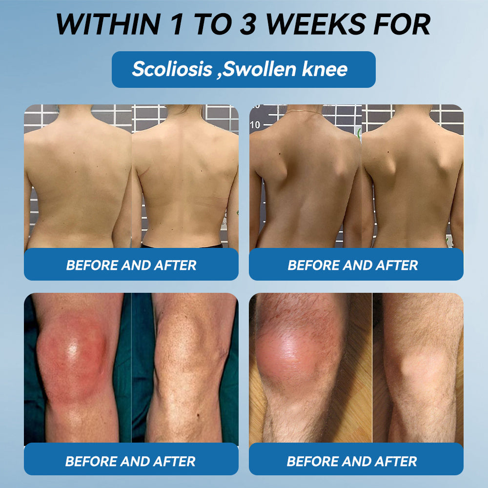 𝐅𝐃𝐀 𝐀𝐩𝐩𝐫𝐨𝐯𝐞𝐝|𝐉𝑶𝗔𝙀® 𝐁𝐏𝐂-𝟏𝟓𝟕 𝐉𝐨𝐢𝐧𝐭 𝐑𝐞𝐬𝐭𝐨𝐫𝐞 𝐎𝐫𝐚𝐥 𝐋𝐢𝐪𝐮𝐢𝐝🦴𝐓𝐫𝐞𝐚𝐭𝐬 𝐀𝐫𝐭𝐡𝐫𝐢𝐭𝐢𝐬, 𝐍𝐞𝐮𝐫𝐨𝐩𝐚𝐭𝐡𝐲, 𝐑𝐡𝐞𝐮𝐦𝐚𝐭𝐢𝐬𝐦, 𝐒𝐩𝐨𝐫𝐭𝐬 𝐈𝐧𝐣𝐮𝐫𝐢𝐞𝐬 & 𝐌𝐨𝐫𝐞🌿