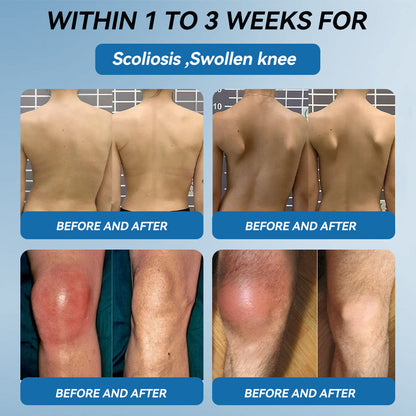 𝐅𝐃𝐀 𝐀𝐩𝐩𝐫𝐨𝐯𝐞𝐝|𝐉𝑶𝗔𝙀® 𝐁𝐏𝐂-𝟏𝟓𝟕 𝐉𝐨𝐢𝐧𝐭 𝐑𝐞𝐬𝐭𝐨𝐫𝐞 𝐎𝐫𝐚𝐥 𝐋𝐢𝐪𝐮𝐢𝐝🦴𝐓𝐫𝐞𝐚𝐭𝐬 𝐀𝐫𝐭𝐡𝐫𝐢𝐭𝐢𝐬, 𝐍𝐞𝐮𝐫𝐨𝐩𝐚𝐭𝐡𝐲, 𝐑𝐡𝐞𝐮𝐦𝐚𝐭𝐢𝐬𝐦, 𝐒𝐩𝐨𝐫𝐭𝐬 𝐈𝐧𝐣𝐮𝐫𝐢𝐞𝐬 & 𝐌𝐨𝐫𝐞🌿