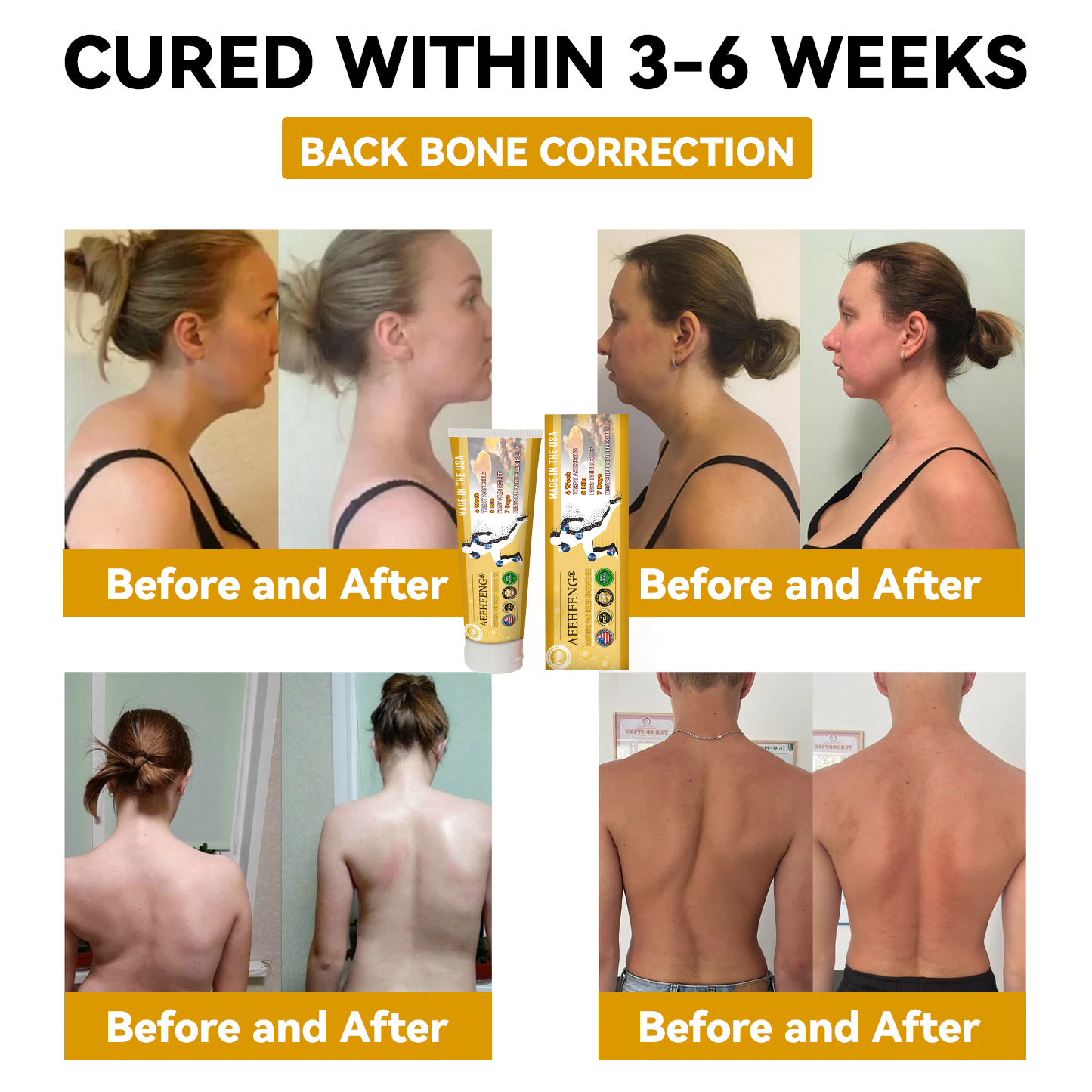 𝐀𝐄𝐄𝐇𝐅𝐄𝐍𝐆® 𝐓𝐮𝐫𝐦𝐞𝐫𝐢𝐜 & 𝐄𝐦𝐮 𝐎𝐢𝐥 𝐀𝐫𝐭𝐡𝐫𝐢𝐭𝐢𝐬 𝐒𝐨𝐨𝐭𝐡𝐢𝐧𝐠 𝐏𝐚𝐢𝐧 𝐑𝐞𝐥𝐢𝐞𝐟 𝐌𝐚𝐬𝐬𝐚𝐠𝐞 𝐆𝐞𝐥