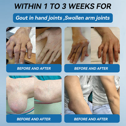 𝐅𝐃𝐀 𝐀𝐩𝐩𝐫𝐨𝐯𝐞𝐝|𝐉𝑶𝗔𝙀® 𝐁𝐏𝐂-𝟏𝟓𝟕 𝐉𝐨𝐢𝐧𝐭 𝐑𝐞𝐬𝐭𝐨𝐫𝐞 𝐎𝐫𝐚𝐥 𝐋𝐢𝐪𝐮𝐢𝐝🦴𝐓𝐫𝐞𝐚𝐭𝐬 𝐀𝐫𝐭𝐡𝐫𝐢𝐭𝐢𝐬, 𝐍𝐞𝐮𝐫𝐨𝐩𝐚𝐭𝐡𝐲, 𝐑𝐡𝐞𝐮𝐦𝐚𝐭𝐢𝐬𝐦, 𝐒𝐩𝐨𝐫𝐭𝐬 𝐈𝐧𝐣𝐮𝐫𝐢𝐞𝐬 & 𝐌𝐨𝐫𝐞🌿