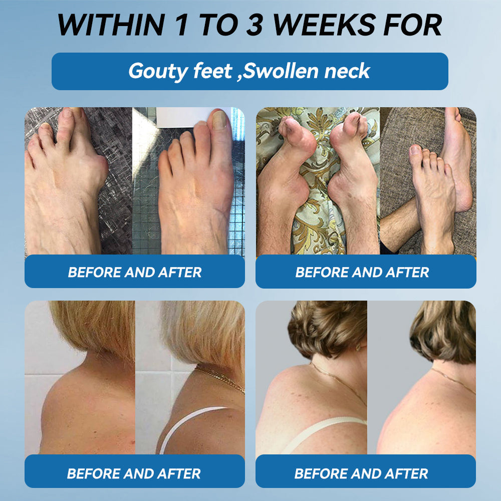 Aeehfeng® Only 6 left! Enjoy an extra 30% off! Experts recommend purchasing 4-5 pieces at once for optimal joint repair and protection. Don't wait—take the first step toward pain-free movement today!