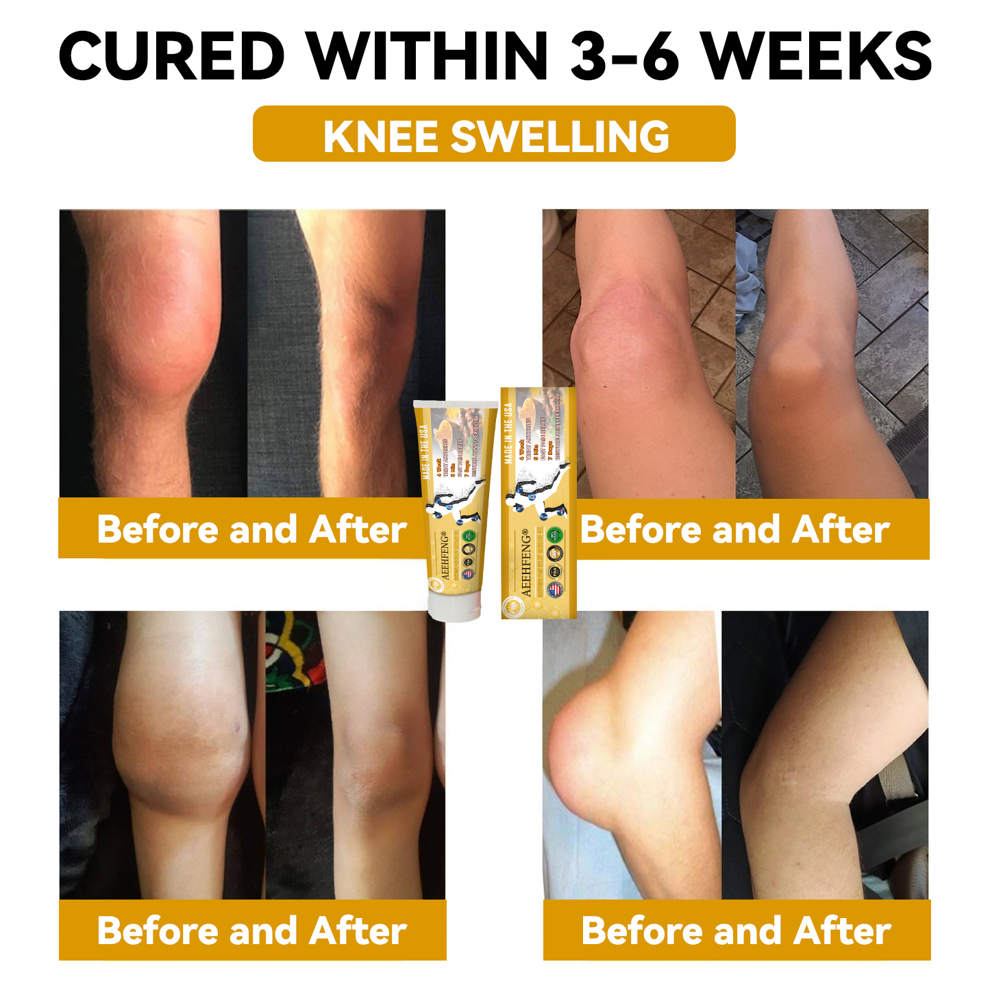 𝐀𝐄𝐄𝐇𝐅𝐄𝐍𝐆® 𝐓𝐮𝐫𝐦𝐞𝐫𝐢𝐜 & 𝐄𝐦𝐮 𝐎𝐢𝐥 𝐀𝐫𝐭𝐡𝐫𝐢𝐭𝐢𝐬 𝐒𝐨𝐨𝐭𝐡𝐢𝐧𝐠 𝐏𝐚𝐢𝐧 𝐑𝐞𝐥𝐢𝐞𝐟 𝐌𝐚𝐬𝐬𝐚𝐠𝐞 𝐆𝐞𝐥