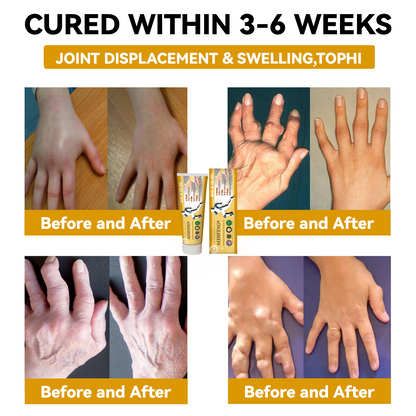 𝐀𝐄𝐄𝐇𝐅𝐄𝐍𝐆® 𝐓𝐮𝐫𝐦𝐞𝐫𝐢𝐜 & 𝐄𝐦𝐮 𝐎𝐢𝐥 𝐀𝐫𝐭𝐡𝐫𝐢𝐭𝐢𝐬 𝐒𝐨𝐨𝐭𝐡𝐢𝐧𝐠 𝐏𝐚𝐢𝐧 𝐑𝐞𝐥𝐢𝐞𝐟 𝐌𝐚𝐬𝐬𝐚𝐠𝐞 𝐆𝐞𝐥
