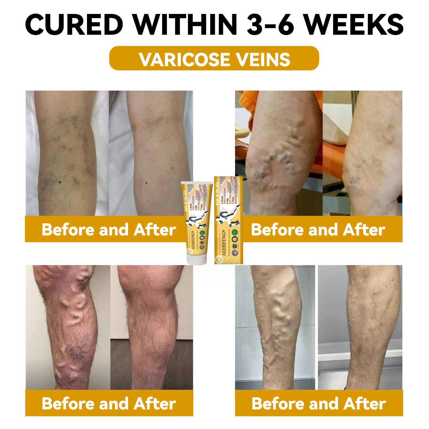 𝐀𝐄𝐄𝐇𝐅𝐄𝐍𝐆® 𝐓𝐮𝐫𝐦𝐞𝐫𝐢𝐜 & 𝐄𝐦𝐮 𝐎𝐢𝐥 𝐀𝐫𝐭𝐡𝐫𝐢𝐭𝐢𝐬 𝐒𝐨𝐨𝐭𝐡𝐢𝐧𝐠 𝐏𝐚𝐢𝐧 𝐑𝐞𝐥𝐢𝐞𝐟 𝐌𝐚𝐬𝐬𝐚𝐠𝐞 𝐆𝐞𝐥